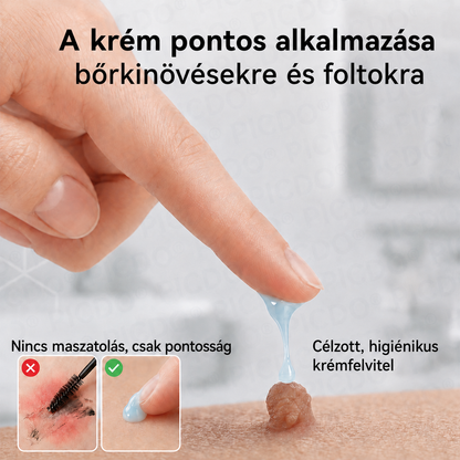Picdo® 7 napos krém bőrkinövések és pigmentfoltok eltávolítására 🧴 (Fájdalommentes formula – hegek nélkül)