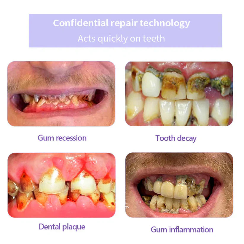 🦷 Pack Terapéutico (4 uds) - €39.97 | ≈€9.99/ud