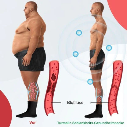 ⚡Tourmaline Thermal Circulation selbsterwärmende formende Socken（🔥Zeitlich begrenzter Rabatt Letzte 30 Minuten）
