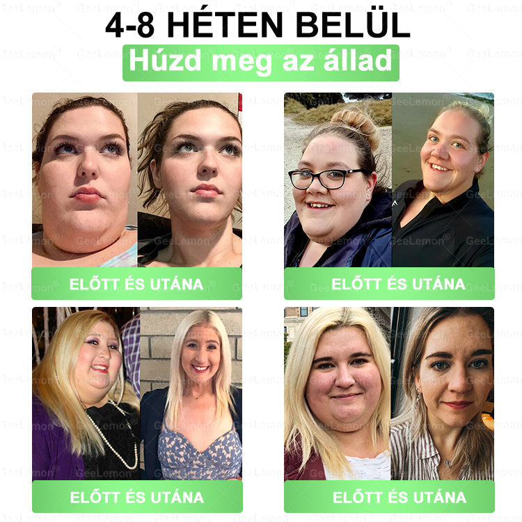 🔥🔥𝐆𝐞𝑒𝐿𝑒𝐦𝐨𝐧® Glumasetide 8 az 1-ben Karcsú és Egészséges Nano Mikrotűs Tapasz