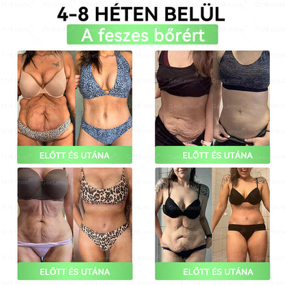 🔥🔥𝐆𝐞𝑒𝐿𝑒𝐦𝐨𝐧® Glumasetide 8 az 1-ben Karcsú és Egészséges Nano Mikrotűs Tapasz